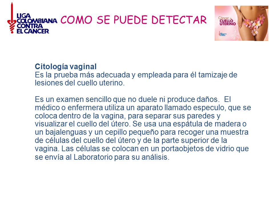 La escoliosis sheynogo del departamento de la columna vertebral el ejército